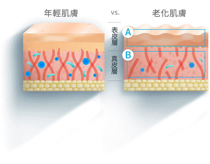 年輕肌膚 vs. 老化肌膚，A表皮層、B真皮層